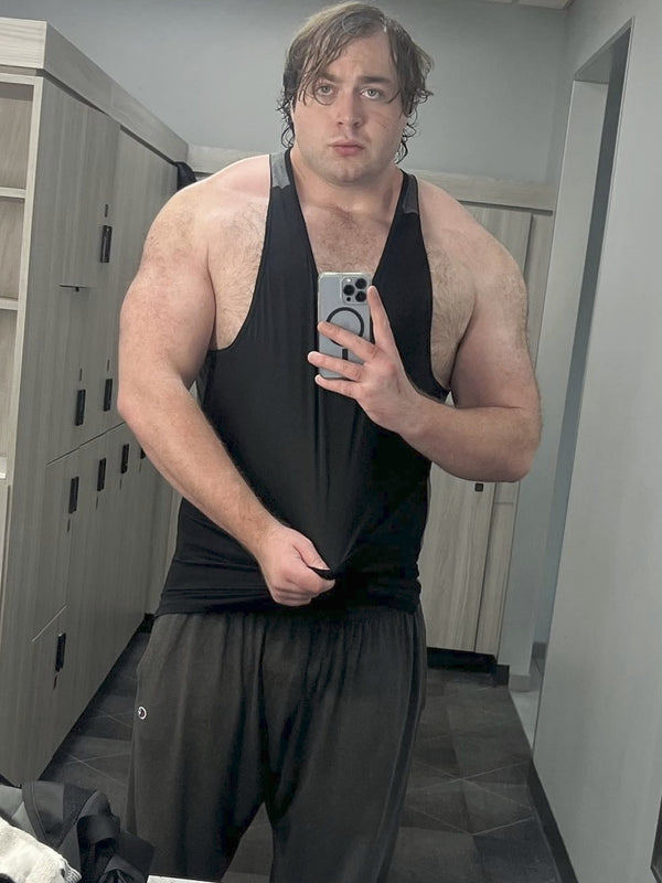 Reid G. - Before