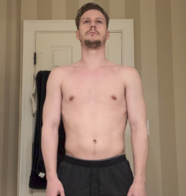 Matthew C. - Before